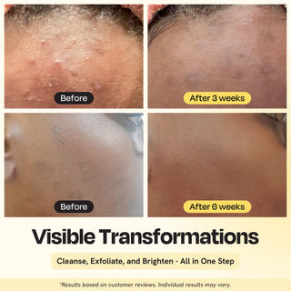 Clarifying Brightening Cleanser